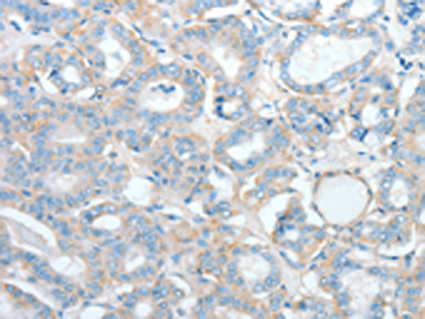 Rabbit Polyclonal Antibody to AGBL2