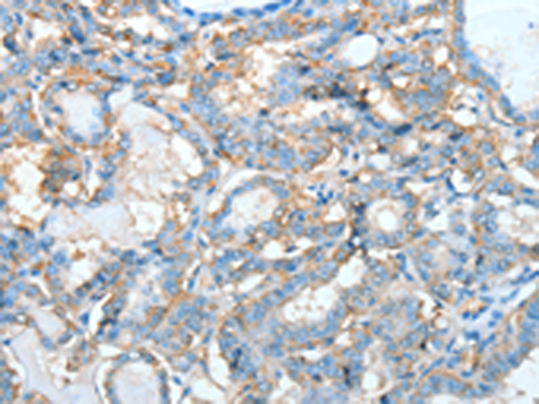 Rabbit Polyclonal Antibody to AGBL3