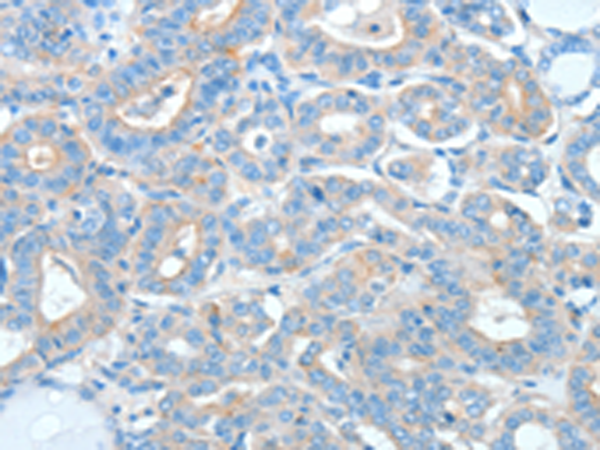 Rabbit Polyclonal Antibody to AGO2