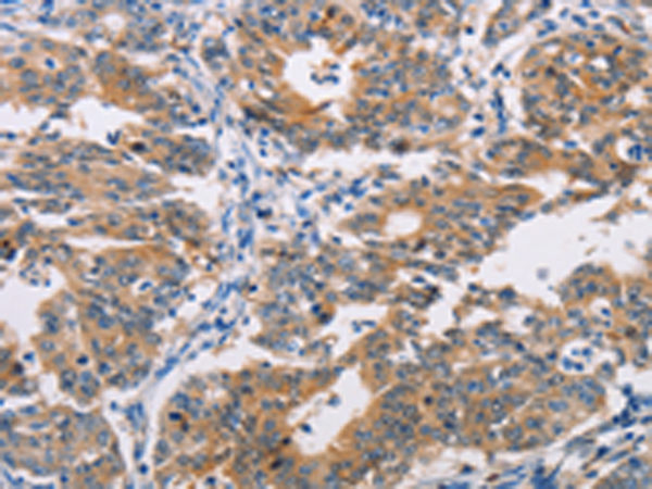 Rabbit Polyclonal Antibody to AGPAT4