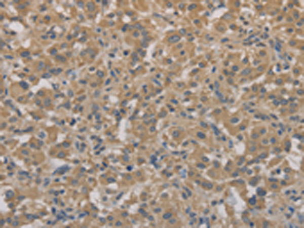 Rabbit Polyclonal Antibody to AGTRAP