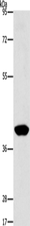 Rabbit Polyclonal Antibody to PHYKPL