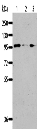 Rabbit Polyclonal Antibody to AKAP8L