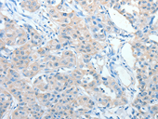 Rabbit Polyclonal Antibody to AKAP9