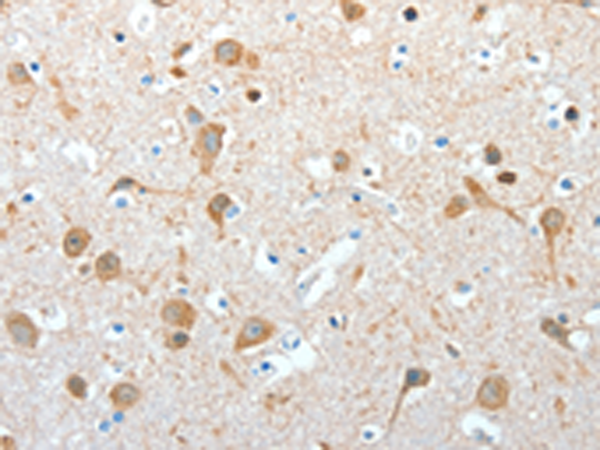 Rabbit Polyclonal Antibody to AKAP4