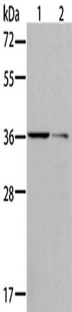 Rabbit Polyclonal Antibody to AKR1B10