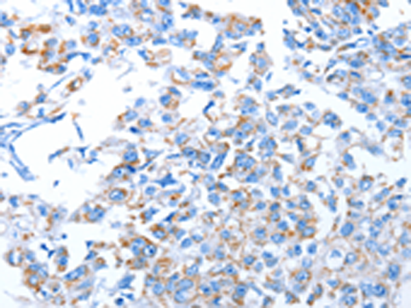 Rabbit Polyclonal Antibody to ALAS1