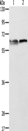 Rabbit Polyclonal Antibody to ALAS2
