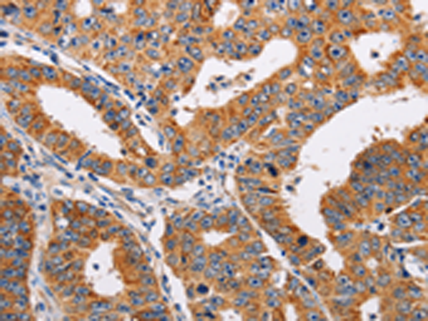 Rabbit Polyclonal Antibody to ADH1A