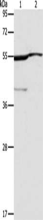 Rabbit Polyclonal Antibody to ALDH3A1