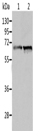 Rabbit Polyclonal Antibody to ALDH4A1
