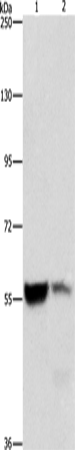 Rabbit Polyclonal Antibody to ALDH8A1