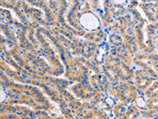 Rabbit Polyclonal Antibody to ALG8