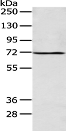 Rabbit Polyclonal Antibody to ALG9