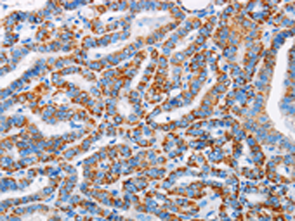 Rabbit Polyclonal Antibody to ALG2