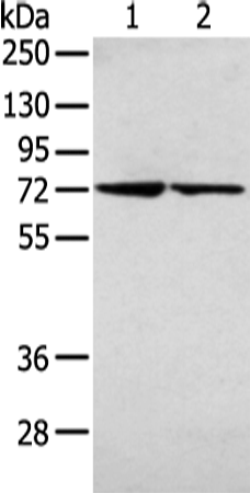 Rabbit Polyclonal Antibody to AGPS