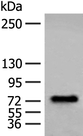 Rabbit Polyclonal Antibody to ALOXE3