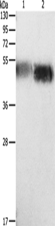 Rabbit Polyclonal Antibody to ORM1
