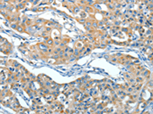 Rabbit Polyclonal Antibody to SERPINA3