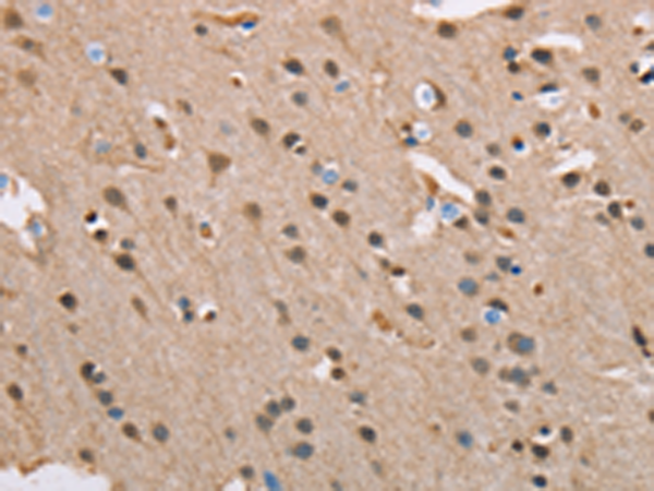 Rabbit Polyclonal Antibody to SERPINA1
