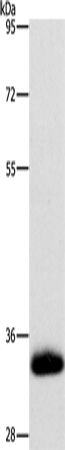 Rabbit Polyclonal Antibody to AMBP