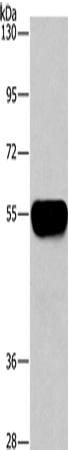 Rabbit Polyclonal Antibody to AHSG