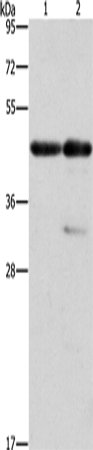 Rabbit Polyclonal Antibody to ACTA1