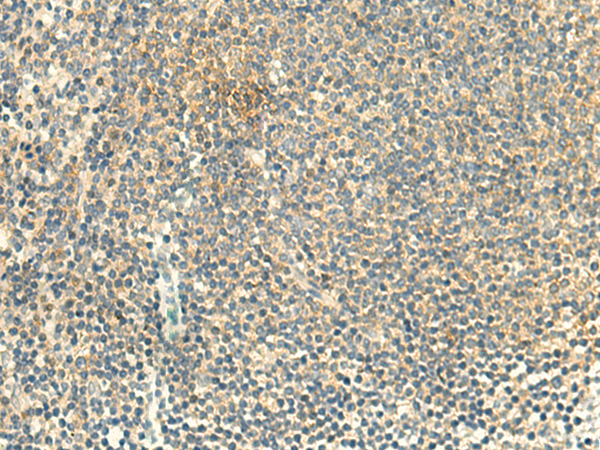 Rabbit Polyclonal Antibody to ALPK1