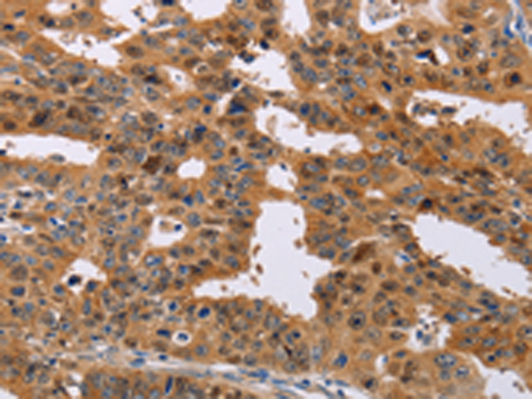 Rabbit Polyclonal Antibody to NIF3L1