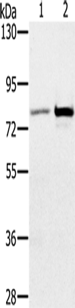 Rabbit Polyclonal Antibody to CARF