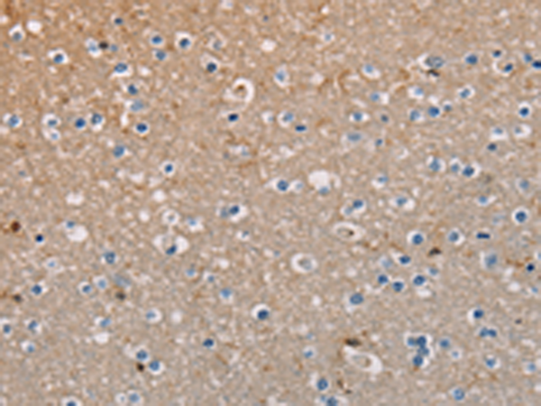 Rabbit Polyclonal Antibody to AMBRA1