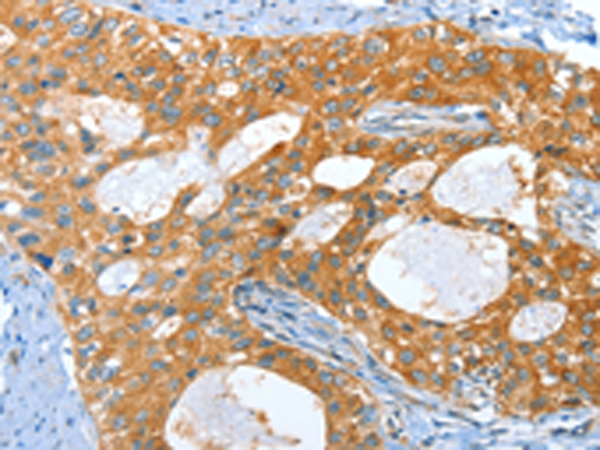 Rabbit Polyclonal Antibody to AMHR2