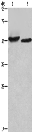 Rabbit Polyclonal Antibody to AMIGO2