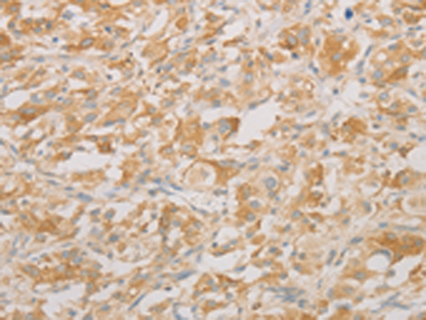 Rabbit Polyclonal Antibody to TLE5