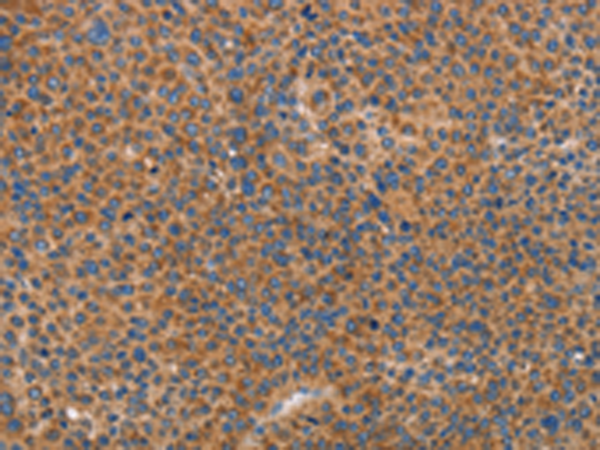 Rabbit Polyclonal Antibody to PRKAA2