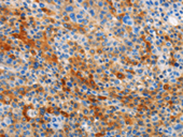 Rabbit Polyclonal Antibody to STAMBP