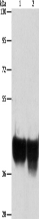 Rabbit Polyclonal Antibody to AUP1
