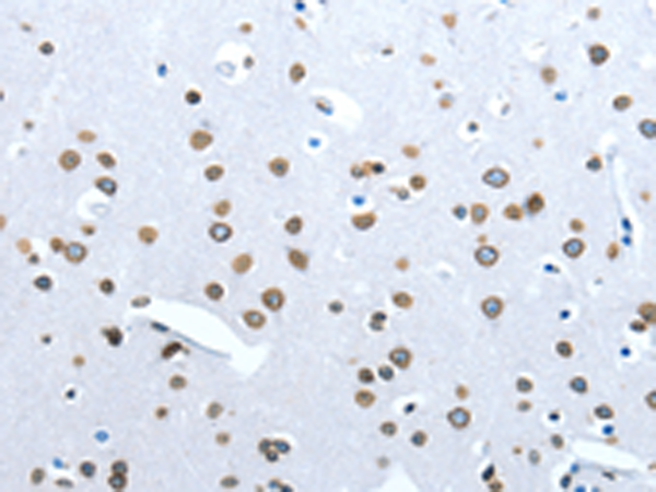 Rabbit Polyclonal Antibody to ACE2
