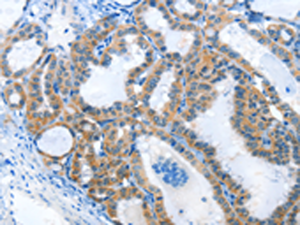 Rabbit Polyclonal Antibody to ANKMY1