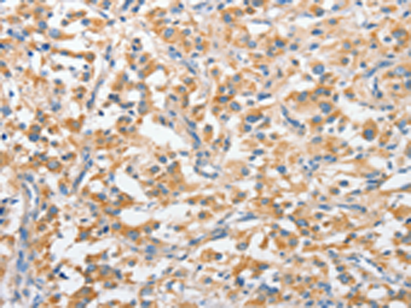 Rabbit Polyclonal Antibody to ANKMY2