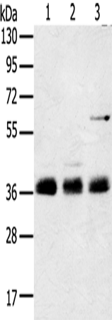 Rabbit Polyclonal Antibody to ANKRD1