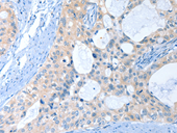 Rabbit Polyclonal Antibody to ANKRD54