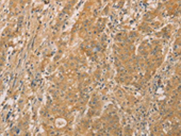 Rabbit Polyclonal Antibody to SNAP91