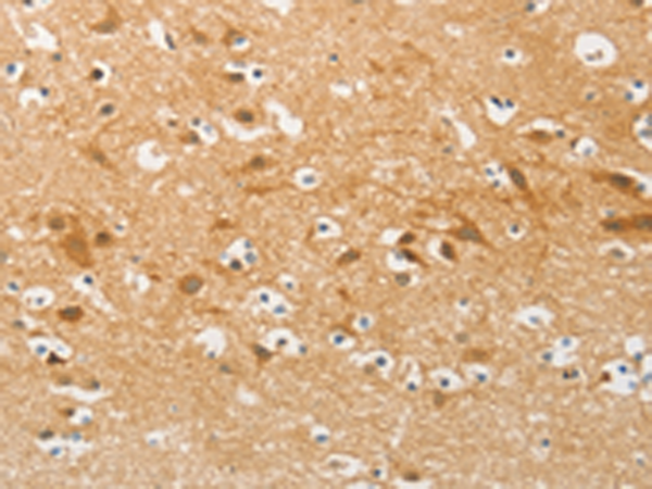 Rabbit Polyclonal Antibody to AP2M1