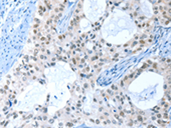 Rabbit Polyclonal Antibody to RPL15