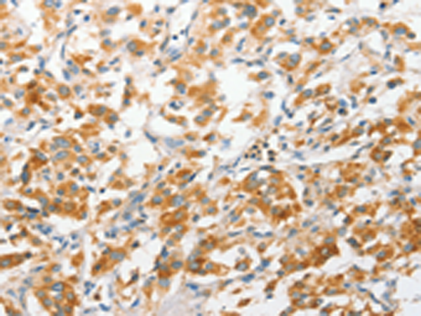 Rabbit Polyclonal Antibody to ANAPC2