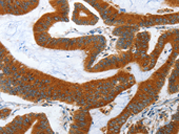 Rabbit Polyclonal Antibody to ANAPC10