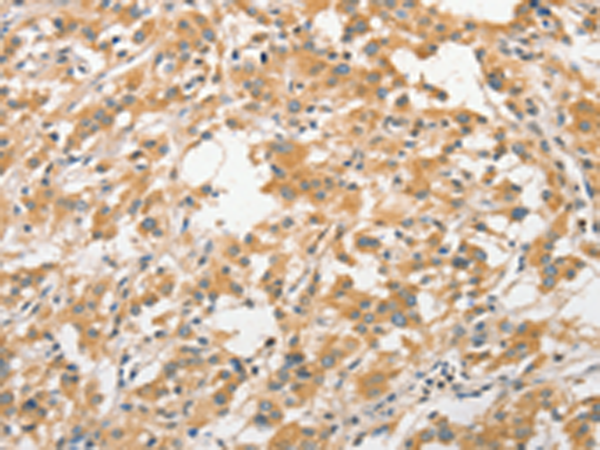 Rabbit Polyclonal Antibody to ANAPC5