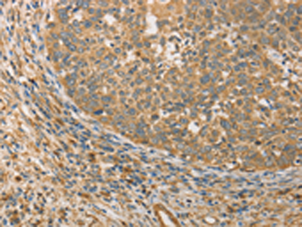Rabbit Polyclonal Antibody to ATG3