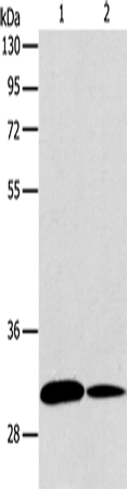 Rabbit Polyclonal Antibody to ATG5